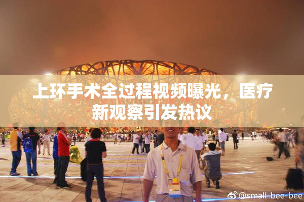 上环手术全过程视频曝光，医疗新观察引发热议