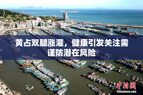 黄占双腿涨灌，健康引发关注需谨防潜在风险