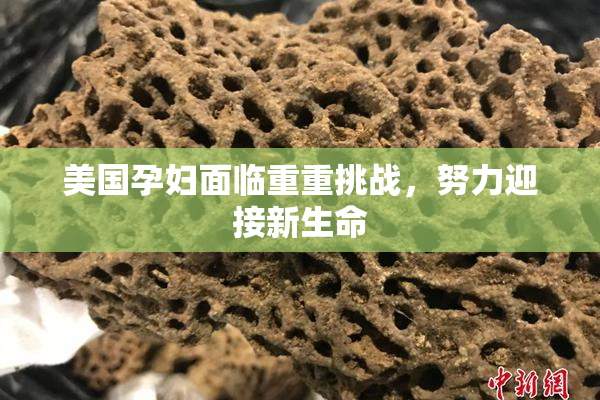 美国孕妇面临重重挑战，努力迎接新生命