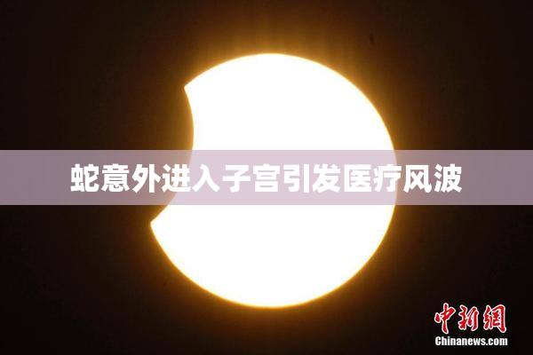 蛇意外进入子宫引发医疗风波