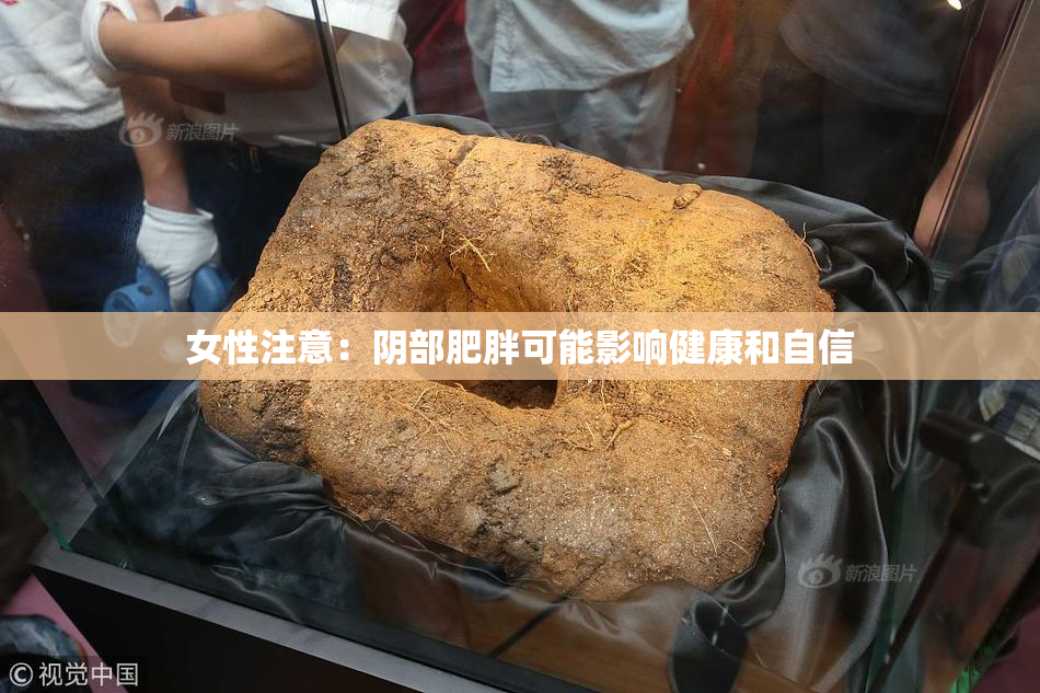 女性注意：阴部肥胖可能影响健康和自信