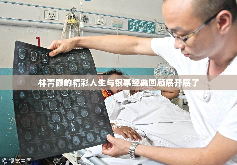 林青霞的精彩人生与银幕经典回顾展开展了
