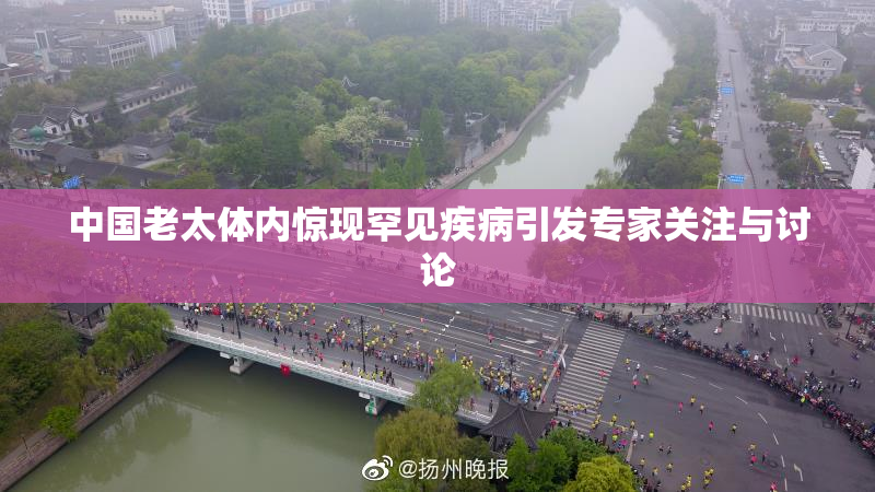 中国老太体内惊现罕见疾病引发专家关注与讨论