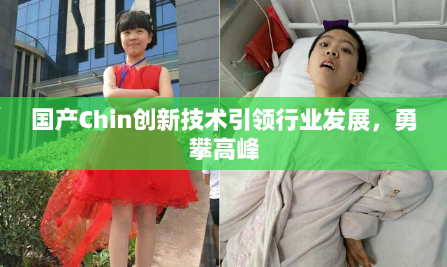 国产Chin创新技术引领行业发展，勇攀高峰