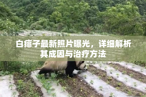 白痱子最新照片曝光，详细解析其成因与治疗方法