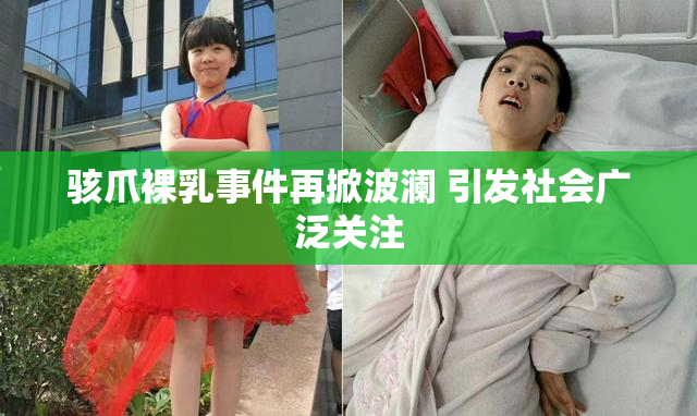 骇爪裸乳事件再掀波澜 引发社会广泛关注