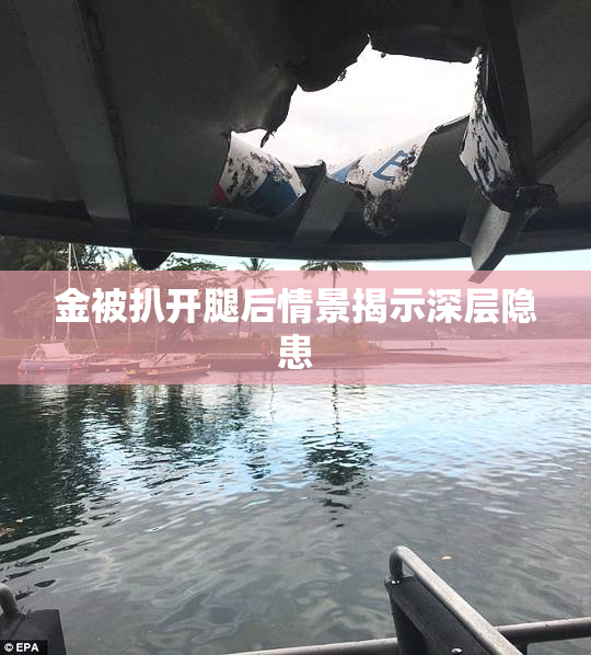 金被扒开腿后情景揭示深层隐患