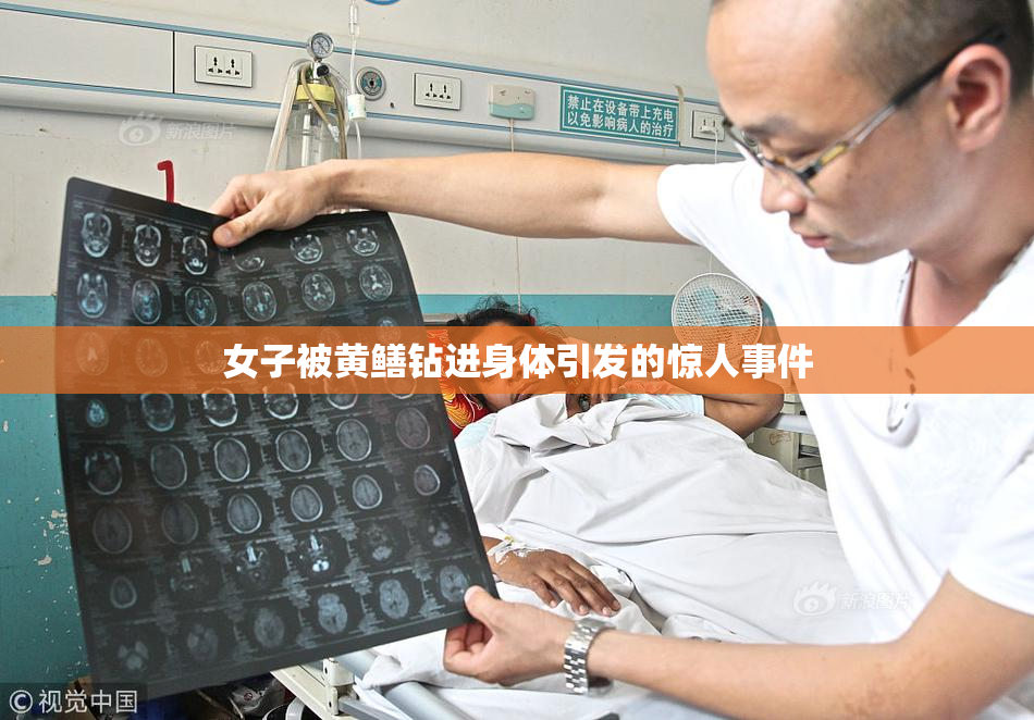 女子被黄鳝钻进身体引发的惊人事件